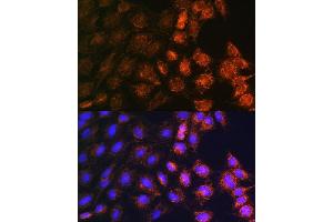 Immunofluorescence (IF) image for anti-Solute Carrier Family 25 (Mitochondrial Carrier: Glutamate), Member 22 (SLC25A22) (AA 128-188) antibody (ABIN7270436)