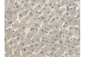 IHC-P analysis of Human Liver Tissue, with DAB staining. (ERBB4 抗体  (AA 29-278))