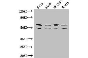 Western Blotting (WB) image for anti-Insulin-Like Growth Factor 2 mRNA Binding Protein 3 (IGF2BP3) (AA 1-100) antibody (ABIN7156360)
