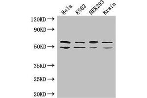 Western Blot Positive WB detected in: Hela whole cell lysate, K562 whole cell lysate, HEK293 whole cell lysate, Mouse brain tissue All lanes: IGF2BP3 antibody at 2 μg/mL Secondary Goat polyclonal to rabbit IgG at 1/50000 dilution Predicted band size: 64, 22 kDa Observed band size: 64, 50 kDa (IGF2BP3 抗体  (AA 1-100))