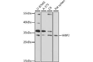 Western blot analysis of extracts of various cell lines, using WBP2 antibody (ABIN7271391) at 1:1000 dilution. (WBP2 抗体  (AA 15-140))