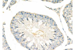 ABIN6265057 and ABIN6279818 at 1/100 staining Rat testis tissue by IHC-P. (SH3GL3 抗体  (Internal Region))
