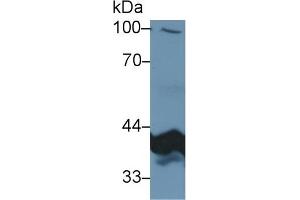 Detection of PDHb in Human Liver lysate using Polyclonal Antibody to Pyruvate Dehydrogenase Beta (PDHb)