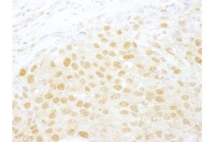 anti-Nuclear Cap Binding Protein Subunit 1, 80kDa (NCBP1) (AA 482-532) antibody