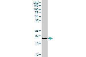 Western Blotting (WB) image for anti-Nucleolar Protein 16 (NOP16) (AA 1-178) antibody (ABIN526757)