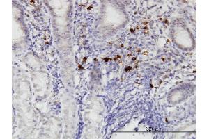 Immunoperoxidase of monoclonal antibody to RASGEF1C on formalin-fixed paraffin-embedded human stomach. (RASGEF1C 抗体  (AA 168-260))
