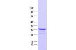 DLX4 Protein (His tag)