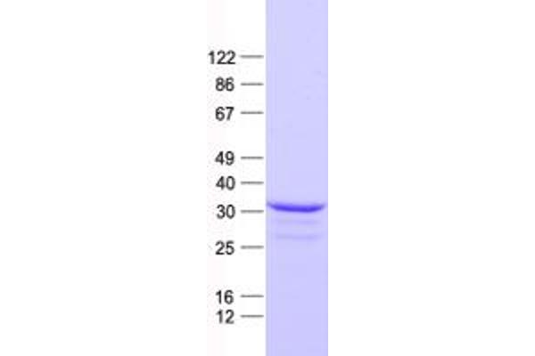 DLX4 Protein (His tag)