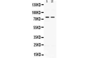 Western blot analysis of ACVR2A expression in rat kidney extract ( Lane 1) and HELA whole cell lysates ( Lane 2). (ACVR2A 抗体  (AA 421-513))