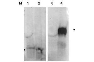 Western blot using  affinity purified anti-FAP antibody shows detection of FAP protein in whole cell lysates from FAP expressing HEK cells (lane 4) but not control HEK cells (lane 3). (FAP 抗体  (Internal Region))