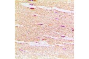 Immunohistochemistry (IHC) image for anti-Sarcoglycan, delta (35kDa Dystrophin-Associated Glycoprotein) (SGCD) antibody (ABIN7308326) (SGCD 抗体)