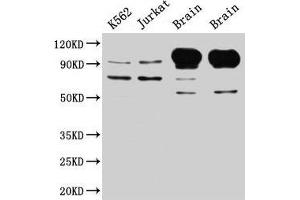 Western Blot Positive WB detected in: K562 whole cell lysate, Jurkat whole cell lysate, Rat brain tissue, Mouse brain tissue All lanes: MAG antibody at 5 μg/mL Secondary Goat polyclonal to rabbit IgG at 1/50000 dilution Predicted band size: 70, 64, 67 kDa Observed band size: 70, 100 kDa (MAG 抗体  (AA 25-516))