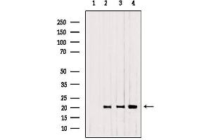 Western blot analysis of extracts from 293，B16F10，Mouse myeloma, using CNPY2,MSAP antibody. (CNPY2/MSAP 抗体  (C-Term))
