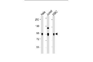 All lanes : Anti-Wee1 Antibody at 1:2000 dilution Lane 1: Hela whole cell lysate Lane 2: Jurkat whole cell lysate Lane 3: K562 whole cell lysate Lysates/proteins at 20 μg per lane. (WEE1 抗体  (Ser123))