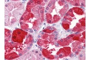Immunohistochemistry (IHC) image for anti-Crystallin, mu (CRYM) (AA 215-315) antibody (ABIN614593) (CRYM 抗体  (AA 215-315))