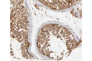 ABIN6266459 at 1/200 staining human testis tissue sections by IHC-P. (FER 抗体  (pTyr402))