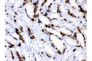 Anti- Band 3 Picoband antibody,IHC(P) IHC(P): Rat Kidney Tissue (Band 3/AE1 抗体  (AA 28-365))