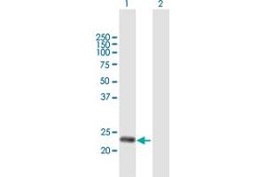 Western Blot analysis of DNAJC30 expression in transfected 293T cell line by DNAJC30 MaxPab polyclonal antibody. (DNAJC30 抗体  (AA 1-226))