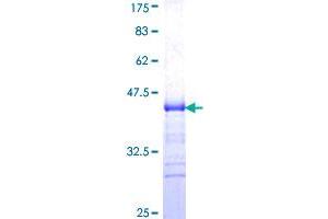 Image no. 1 for Tumor Necrosis Factor Receptor Superfamily, Member 4 (TNFRSF4) (AA 31-130) protein (GST tag) (ABIN1323195)