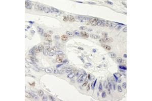Immunohistochemistry (IHC) image for anti-Symplekin (SYMPK) (AA 1224-1274) antibody (ABIN7448822) (Symplekin 抗体  (AA 1224-1274))