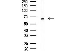 Western blot analysis of lysates from Mouse testis, using Dcp2 Antibody at 1/1000 dilution.
