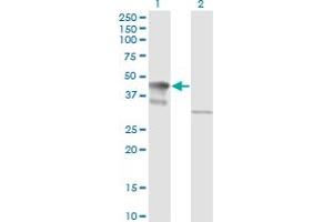 Western Blot analysis of MAPK3 expression in transfected 293T cell line by MAPK3 monoclonal antibody (M05), clone 3D6. (ERK1 抗体  (AA 279-379))