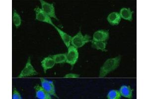 Immunofluorescence (IF) image for anti-Methylenetetrahydrofolate Dehydrogenase (NADP+ Dependent) 2, Methenyltetrahydrofolate Cyclohydrolase (MTHFD2) antibody (ABIN7255295)