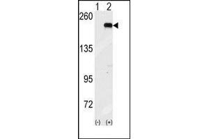 Western blot analysis of GCN2 (arrow) using GCN2 Antibody (GCN2 抗体  (C-Term))