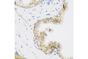 Immunohistochemistry of paraffin-embedded human prostate using KIAA1456 antibody at dilution of 1:200 (40x lens). (KIAA1456 抗体)