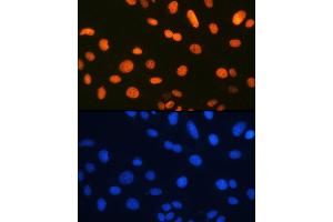Immunofluorescence analysis of U-2 OS cells using Ku80 Rabbit mAb (ABIN7271406) at dilution of 1:100 (40x lens). (XRCC5 抗体)