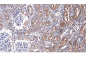 Detection of CD164 in Rat Kidney Tissue using Polyclonal Antibody to Cluster Of Differentiation 164 (CD164) (CD164 抗体  (AA 24-160))