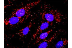 Proximity Ligation Analysis of protein-protein interactions between TP53 and BCR. (BCR 抗体  (AA 182-280))