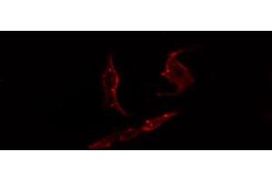 ABIN6274444 staining COLO205 cells by IF/ICC. (PARD3 抗体  (C-Term))