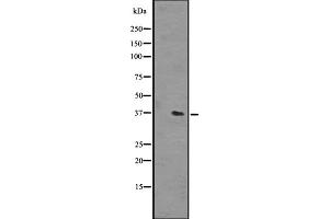 Western blot analysis of OR51L1 expression in NCI-H292 cell line lysates ,The lane on the left is treated with the antigen-specific peptide. (OR51L1 抗体  (Internal Region))