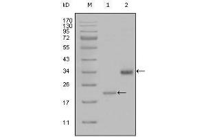 Western blot analysis using LPA mouse mAb against truncated LPA-His recombinant protein (1) and truncated Trx-LPA(aa4330-4521) recombinant protein (2). (LPA 抗体)