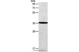 Western blot analysis of Human fetal brain tissue, using AASDHPPT Polyclonal Antibody at dilution of 1:650 (AASDHPPT 抗体)