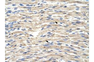 CARF antibody was used for immunohistochemistry at a concentration of 4-8 ug/ml to stain Skeletal muscle cells (arrows) in Human Muscle. (CDKN2AIP 抗体  (C-Term))