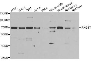 Western blot analysis of extracts of various cell lines, using RNGTT antibody (ABIN5973831) at 1/1000 dilution. (RNGTT 抗体)