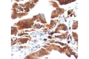Formalin-fixed, paraffin-embedded human gallbladder stained with TOP1MT antibody (TOP1MT/488). (TOP1MT 抗体)