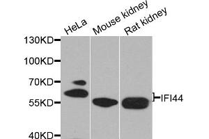 Western blot analysis of extracts of various cell lines, using IFI44 antibody. (IFI44 抗体)