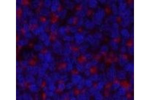 Immunofluorescence analysis of Rat spleen tissue using JAK2 Polyclonal Antibody at dilution of 1:200. (JAK2 抗体)