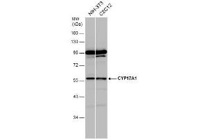 WB Image Various whole cell extracts (30 μg) were separated by 10% SDS-PAGE, and the membrane was blotted with CYP17A1 antibody [N1C2] , diluted at 1:1000. (CYP17A1 抗体  (Center))