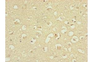 Immunohistochemistry (IHC) image for anti-ATP Synthase, H+ Transporting, Mitochondrial Fo Complex, Subunit D (ATP5H) (AA 1-161) antibody (ABIN7144845)