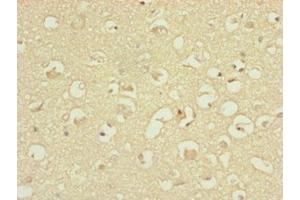 Immunohistochemistry of paraffin-embedded human brain tissue using ABIN7144845 at dilution of 1:100 (ATP5H 抗体  (AA 1-161))