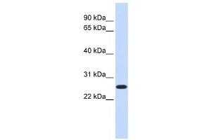 Western Blotting (WB) image for anti-CTD Nuclear Envelope Phosphatase 1a (CTDNEP1A) antibody (ABIN2459072) (CTDNEP1A 抗体)