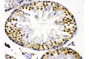 Anti- Cdk2 Picoband antibody,IHC(P) IHC(P): Rat Testis Tissue (CDK2 抗体  (AA 81-298))
