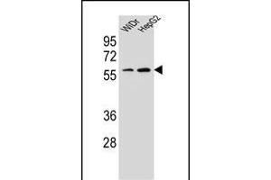 HOXA10 Antibody (Center) (ABIN654234 and ABIN2844067) western blot analysis in WiDr,HepG2 cell line lysates (35 μg/lane). (HOXA10 抗体  (AA 244-271))
