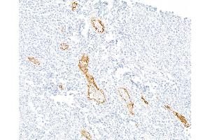 Immunohistochemistry (IHC) image for anti-Selectin P (Granule Membrane Protein 140kDa, Antigen CD62) (SELP) (AA 42-709) antibody (ABIN7795666)
