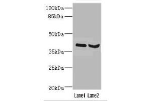Western blot All lanes: HOXD10 antibody at 3.