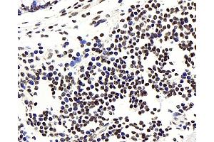 Immunohistochemistry analysis of paraffin-embedded human colon using NFKBIB Polyclonal Antibody at dilution of 1:300. (NFKBIB 抗体)